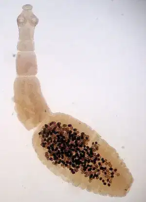 Echinococcus_granulosus.jpg